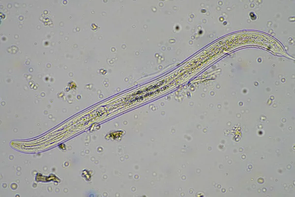 Microrganismi Biologia Nel Compost Nel Campione Terreno Microscopio Australia — Foto Stock