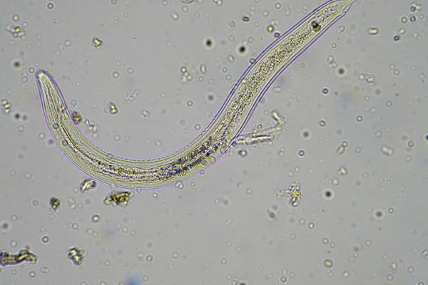 澳大利亚显微镜下堆肥和土壤样品中的微生物与生物学研究 — 图库照片