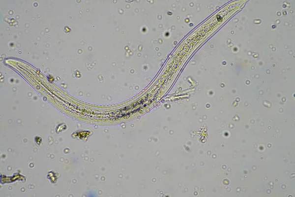 Mikroorganizmy Biologia Gleby Nicieniami Grzybami Pod Mikroskopem Próbce Gleby Kompostu — Zdjęcie stockowe