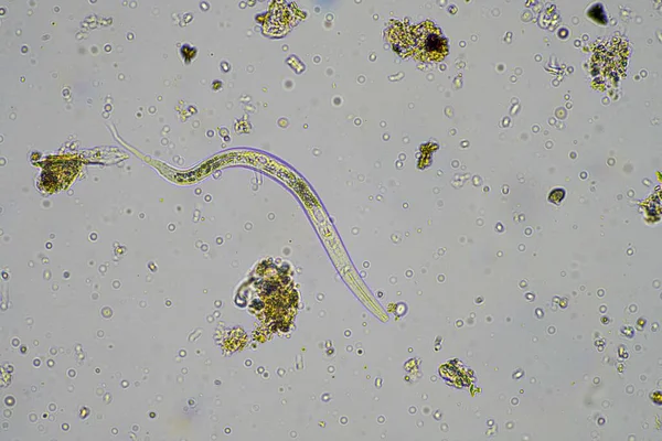 Talajgombák Mikroorganizmusok Fonálférgek Talajban Komposzt Minta Németországban — Stock Fotó