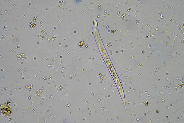 Markmikroorganismer Inklusive Nematod Mikroleddjur Mikroleddjur Tardigrade Och Rotiferer Ett Jordprov — Stockfoto