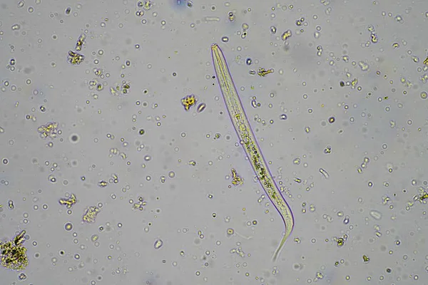 microorganisms and soil biology, with nematodes and fungi under the microscope in a soil compost sample