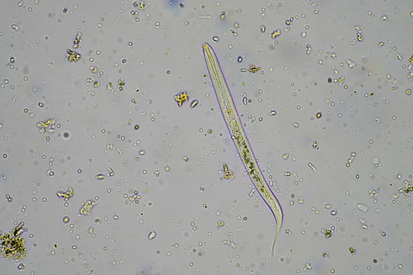 Markmikroorganismer Inklusive Nematod Mikroleddjur Mikroleddjur Tardigrade Och Rotiferer Ett Jordprov — Stockfoto
