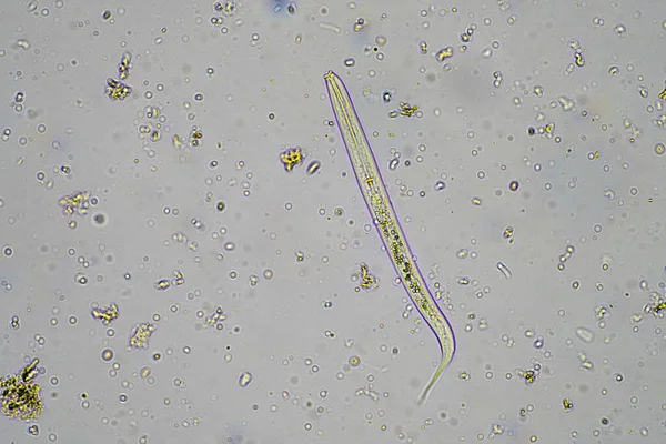Mikroorganizmy Biologia Próbce Kompostu Gleby Pod Mikroskopem Australii — Zdjęcie stockowe