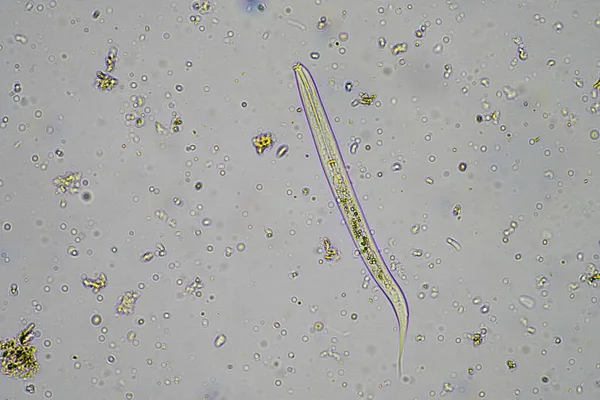 Mikroorganismer Och Markbiologi Med Nematoder Och Svampar Mikroskopet Ett Jord — Stockfoto
