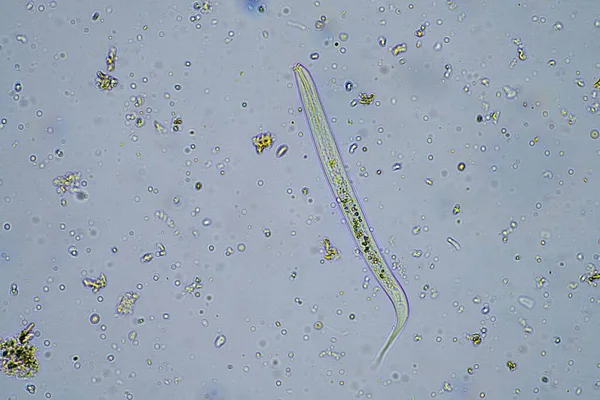微生物学と土壌生物学では線虫と真菌を土壌堆肥サンプルに入れ — ストック写真