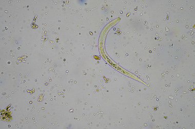 mikroorganizmalar ve toprak biyolojisi, mikroskop altında nematodlar ve mantarlar. Avustralya 'da bir toprak ve gübre örneğinde.