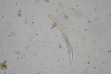Kompost 'taki mikroorganizmalar ve biyoloji ve Avusturalya' daki mikroskop altında toprak örneği
