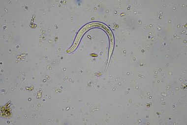 Avustralya topraklarında böcek paraziti var. 