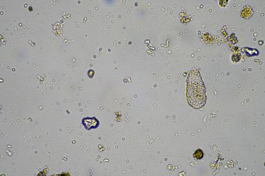Topraktaki toprak mantarları, mikroorganizmalar ve nematodlar ve Almanya 'daki gübre örnekleri