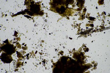 Kompost 'taki mikroorganizmalar ve biyoloji ve Avusturalya' daki mikroskop altında toprak örneği