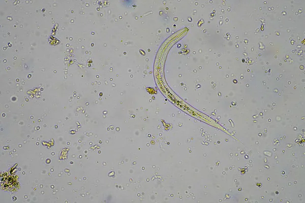 Microrganismos Biologia Solo Com Nematoides Fungos Microscópio Numa Amostra Solo — Fotografia de Stock