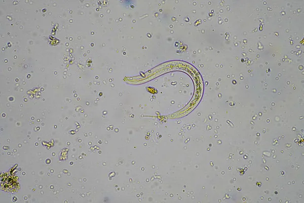 微生物和土壤生物 显微镜下土壤堆肥样本中的线虫和真菌 — 图库照片