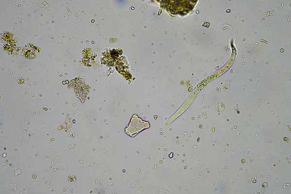 显微镜下堆肥堆肥中的土壤微生物 包括线虫 微节肢动物 微节肢动物 防腐剂和轮虫 土壤样品 土壤真菌和细菌 百万美元 — 图库照片