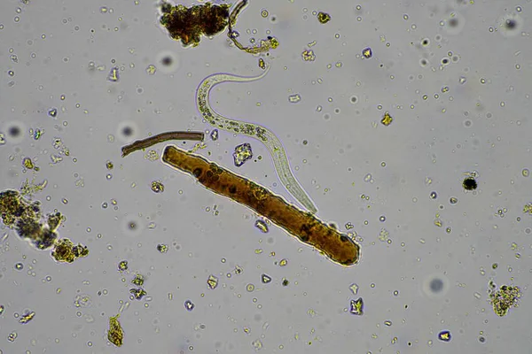 Soil Microorganisms Including Nematode Microarthropods Micro Arthropod Tardigrade Rotifers Soil — Stock Photo, Image