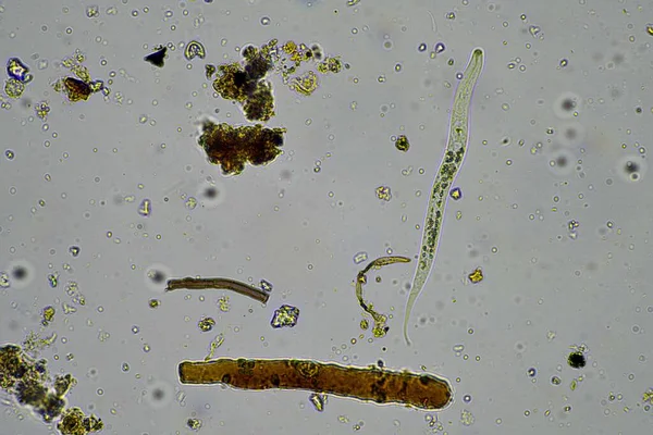 微生物和土壤生物 显微镜下有线虫和真菌 在澳大利亚的土壤和堆肥样本中 — 图库照片