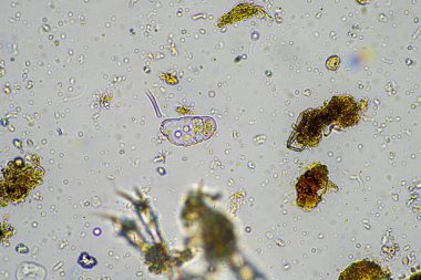 Avustralya 'da sürdürülebilir bir tarım çiftliğinde bakteri, mantar, amip, kırbaç ve arcella içeren toprak örneği. 