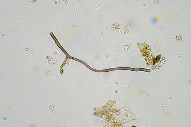 Avustralya 'da bir çiftlikteki toprakta mantar hyphae