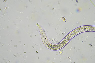 mikroorganizmalar ve toprak biyolojisi, mikroskop altında nematodlar ve mantarlar. Avustralya 'da bir çiftlikteki toprak ve gübre örneğinde.