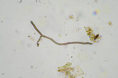 Avustralya 'da bir çiftlikteki toprakta mantar hyphae
