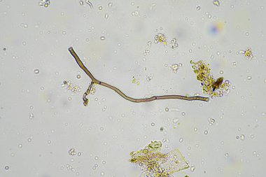 Avustralya 'da bir çiftlikteki toprakta mantar hyphae