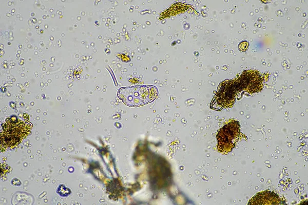 Bodemmonster Met Bodembiologie Met Bacteriën Schimmels Amoebe Flagellaat Arcella Een — Stockfoto