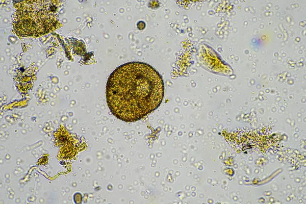 Próbka Gleby Zawierająca Biologię Gleby Bakteriami Grzybami Amebą Flagellanem Arcellą — Zdjęcie stockowe