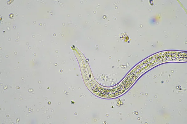 微生物や土壌生物で線虫や真菌を顕微鏡下で観察できます オーストラリアの農場で採取した土や堆肥のサンプルの中で — ストック写真