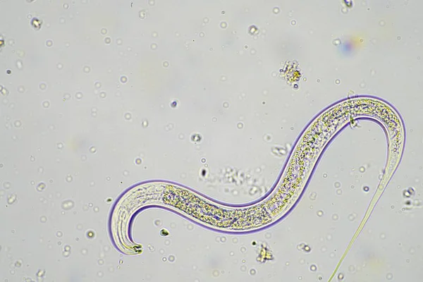 Μικροοργανισμοί Και Βιολογία Του Εδάφους Νηματώδεις Και Μύκητες Στο Μικροσκόπιο — Φωτογραφία Αρχείου