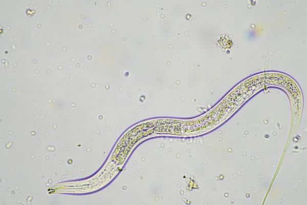 Microrganismos Biologia Solo Com Nematoides Fungos Microscópio Numa Amostra Solo — Fotografia de Stock