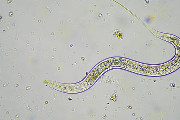 Mikroorganizmy Biologia Gleby Nicieniami Grzybami Pod Mikroskopem Próbce Gleby Kompostu — Zdjęcie stockowe