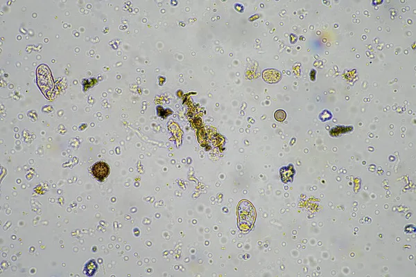 Soil Sample Containing Soil Biology Bacteria Fungi Amoeba Flagellate Arcella — Stock Photo, Image