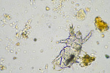 Topraktaki toprak ve gübre örnekleri, mantar ve mantarlar ve rejeneratif tarımda mikroskop altında bulunan toprak mikropları. Avusturalya 'da