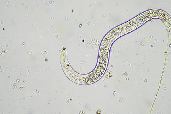 微生物や土壌生物で線虫や真菌を顕微鏡下で観察できます オーストラリアの農場で採取した土や堆肥のサンプルの中で — ストック写真