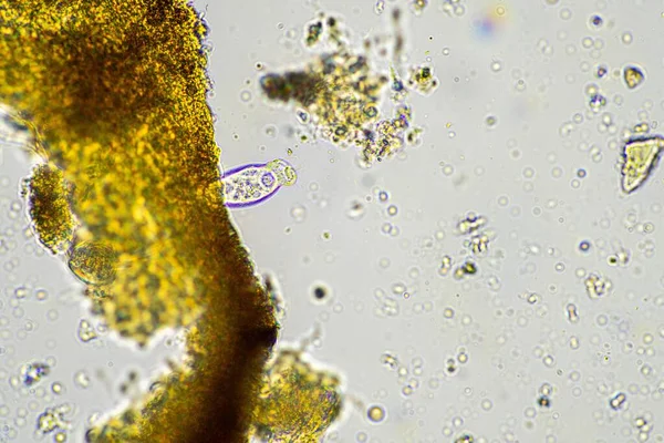 Bodemmicroben Een Bodemmonster Compostmonster Schimmel Schimmel Onder Microscoop Regeneratieve Landbouw — Stockfoto