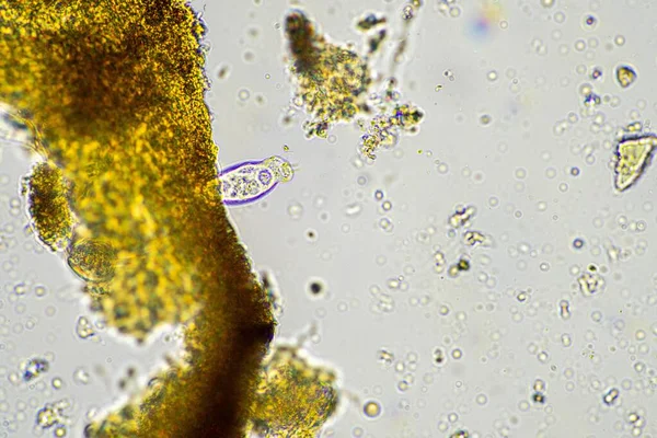 Microrganismos Solo Uma Amostra Solo Composto Fungos Fungos Sob Microscópio — Fotografia de Stock