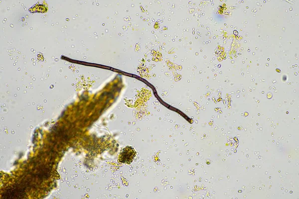 stock image fungi hyphae in soil on a farm in australia