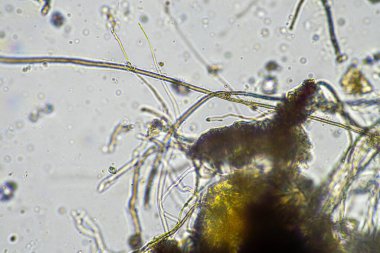 Bir testte mikroskop altında mantar hyphae