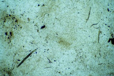 bir laboratuarda mikroskop altında nematode