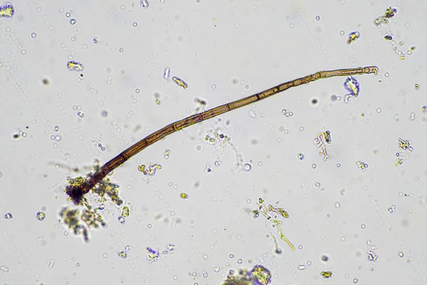 真菌ハイフーを顕微鏡下で観察しました — ストック写真