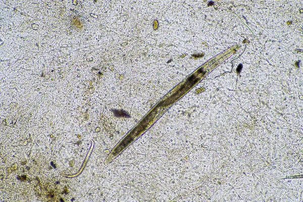 实验室显微镜下的线虫 — 图库照片