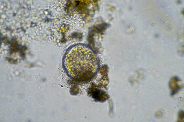 Laboratuvardaki bir numunede ciliate sporu.