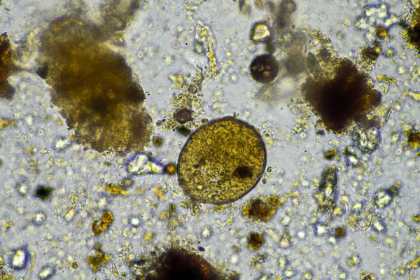 Arcella Testate Amoebae Microscope Soil Sample Farm Living Soil Regenerative — Stock Photo, Image