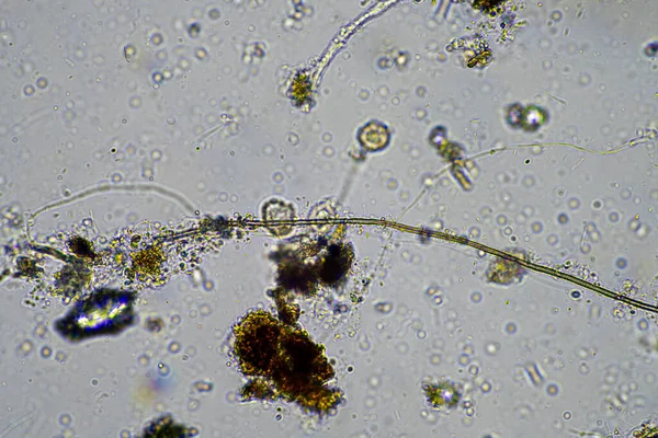 fungal hyphae on a soil sample on a farm. fungi storing carbon in the soil in australia