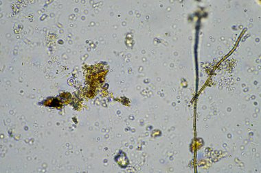 Çiftlikteki toprak örneğinde mantar hyphae. Bir çiftlikteki toprakta karbon depolayan mantarlar