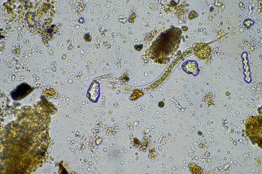 Bakteriyel beslenme toprağı nematodu mikroskop altında rejeneratif bir çiftlikte toprak örneğinde.