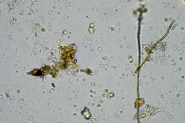 fungal hyphae on a soil sample on a farm. fungi storing carbon in the soil on a ranch
