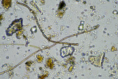Çiftlikteki toprak örneğinde mantar hyphae. Bir çiftlikteki toprakta karbon depolayan mantarlar