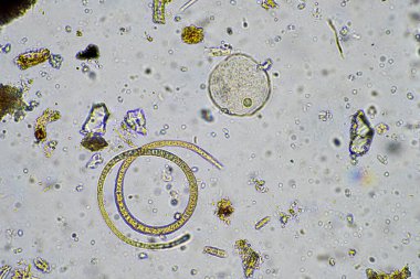 Bir laboratuarda mikroskop altında toprak numunesinde yaşayan yaşam.