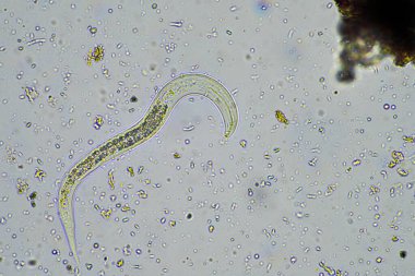 Avusturalya 'da bir çiftlikte mikroskop altında toprak numunesinde bakteriyel beslenme toprağı nematodu. 